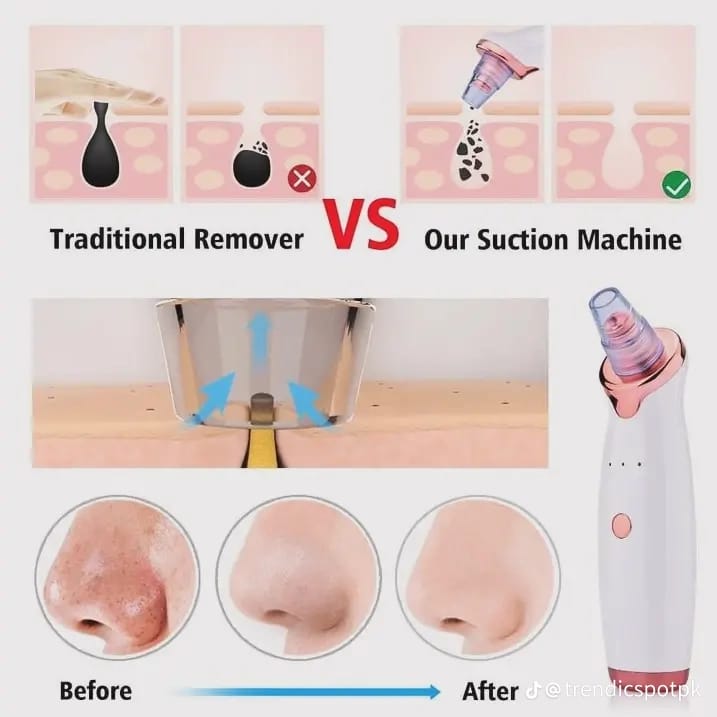 Pore Cleaner Vacuum Device